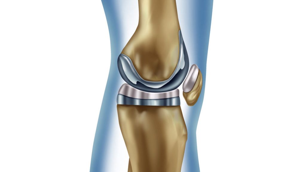 Knee Replacement treatment cost in hyderabad